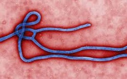 5 lời khuyên từ CNN để đối phó với bệnh dịch Ebola