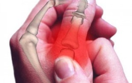 Thói quen bẻ khớp ngón tay kêu "rắc rắc": Tưởng toàn hại hóa ra cũng có lợi