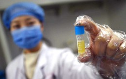 Trung Quốc "khủng hoảng tinh trùng", một bệnh viện kêu gọi thanh niên hiến tinh trùng lấy tiền mua iPhone 7