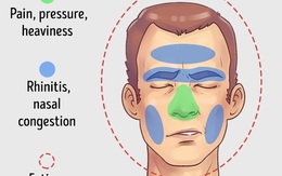5 chứng đau đầu phổ biến nhất và những phương pháp giảm đau hiệu quả
