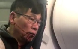 Bác sĩ gốc Việt bị đá khỏi máy bay của United Airlines vẫn nằm viện, thuê hai luật sư để khởi kiện
