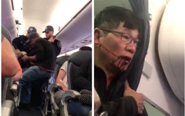 CEO United Airlines gọi hành khách bị lôi khỏi máy bay kín chỗ là “kẻ gây rối và hiếu chiến”