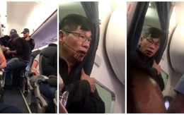 Khách đổ máu khi bị lôi khỏi chỗ trên chuyến bay của hãng hàng không lớn thứ 2 thế giới