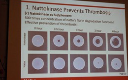 Nattokinase Nhật Bản - Giúp đánh tan cục máu đông, phòng ngừa tai biến đột quỵ