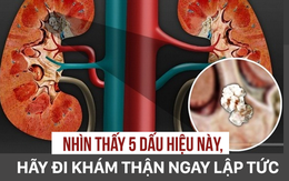 5 dấu hiệu cảnh báo thận của bạn đang "kêu cứu", hãy lắng nghe cơ thể để xử lý kịp thời