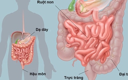 [Đọc nhanh] Danh y chỉ lý do gây bẩn đường ruột, cách làm sạch ruột ai cũng nên thực hiện