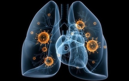 [Đọc nhanh] Cách loại bỏ độc tố ra khỏi phổi: Muốn ngừa ung thư, phải bắt đầu từ việc nhỏ