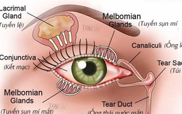 Cách giảm triệu chứng khô mắt tự nhiên: Anh, chị em nào làm văn phòng cũng nên biết