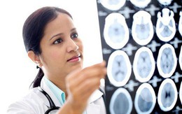 6 dấu hiệu cảnh báo có thể bạn đang có một khối u trong não