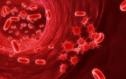 Tiến sĩ Mỹ hướng dẫn 5 bước làm sạch hệ bạch huyết, ngừa mọi bệnh tật