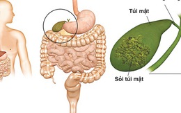 Cách nhận diện 10 dấu hiệu bất thường cảnh báo túi mật có vấn đề