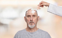 Muốn ngăn ngừa bệnh Alzheimer khi về già, đây là 4 bước giúp bạn tăng cường sức mạnh não bộ dễ dàng mà hiệu quả