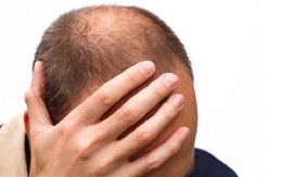 Áp lực công việc và nỗi niềm khó nói của nhiều doanh nhân trẻ