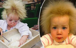 Kỳ lạ bé gái 8 tuổi thừa hưởng mái tóc “dựng đứng” của nhà bác học thiên tài Albert Einstein