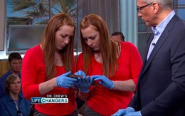 Rùng mình với lá gan của người hay uống rượu, xem xong phải ngay lập tức tìm cách bảo vệ bản thân