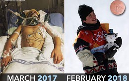 Suýt chết vì tai nạn, vận động viên này đã hồi phục thần kỳ để giành huy chương Olympic chỉ sau 1 năm