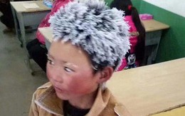 Cậu bé "tóc đóng băng" nổi tiếng Trung Quốc bị buộc thôi học chỉ sau một tuần đến trường mới