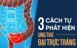 Cách tự kiểm tra ung thư đại trực tràng: Phát hiện sớm 3 tháng, có thể sống thêm 30 năm