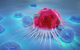 Liệu chúng ta có thể giết chết tế bào ung thư khi chúng đang "ngủ"?