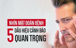 5 thay đổi trên mặt là dấu hiệu cảnh báo bệnh nguy hiểm đang phát triển: Hãy đề phòng sớm!