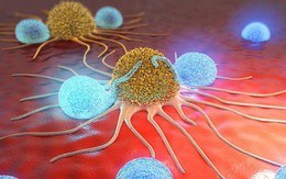 10 giải pháp "phong tỏa" tế bào ung thư: Nếu muốn phòng bệnh hiệu quả, hãy tham khảo ngay