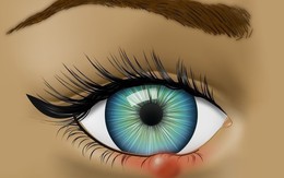 Mắt đột nhiên đỏ ngầu có thể là do 4 nguyên nhân sức khỏe mà bạn không ngờ đến
