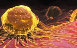 Uống hạt nano vàng: Không tác dụng chữa ung thư, thậm chí gây độc
