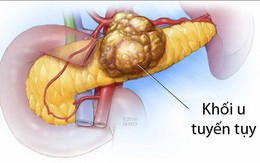 Đây là những dấu hiệu cảnh báo bạn có thể mắc một trong những bệnh ung thư cướp đi nhiều sinh mạng bệnh nhân nhất