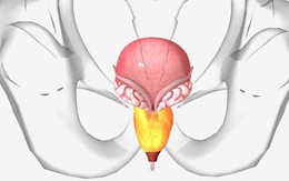 Bác sĩ cảnh báo sớm 5 triệu chứng viêm tuyến tiền liệt: Nếu ai thấy giống là phải đi khám