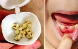 Đánh răng 2 lần/ngày thôi chưa đủ, nha sĩ nào cũng muốn bạn biết những điều này để bảo vệ răng miệng