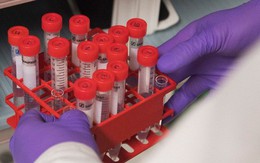 GĐ Ngân hàng Tế bào gốc: 7 bước của liệu pháp chữa ung thư 1 lần duy nhất - cực kỳ đắt đỏ