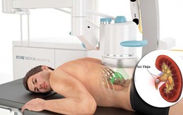 Điều trị sỏi thận từ đơn giản đến phức tạp