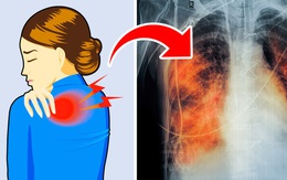 5 dấu hiệu tưởng đơn giản nhưng báo hiệu phổi đang tổn thương nghiêm trọng: Phát hiện sớm có thể cứu mạng nhiều người