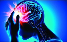 Dược Hậu Giang và bài toán hóa giải nỗi lo đột quỵ ngày càng trẻ hóa