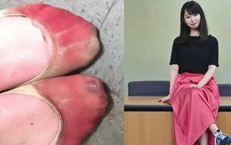 Phong trào #KuToo: Đôi chân rớm máu vì giày cao gót và lời kêu cứu của phụ nữ Nhật Bản chốn công sở