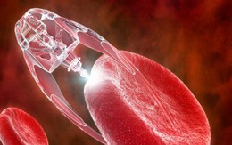 Tiêu diệt tế bào ung thư bằng phân tử nano từ lá trà - hy vọng mới cho những người đang điều trị ung thư phổi