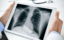 Việt Nam xây dựng thành công phần mềm đọc bệnh qua ảnh X quang: Hiệu quả cực cao, tạo đột phá mới trong ngành y tế