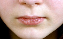 6 vấn đề sức khỏe ở vùng răng miệng mà không phải ai cũng biết, đặc biệt là cái số 3