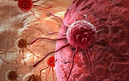 Hy vọng mới cho bệnh nhân ung thư vú: Có thể biến tế bào ung thư vú thành tế bào mỡ vô hại