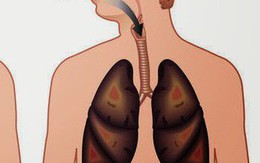 Một số phương pháp tự nhiên mà ai cũng có thể thực hiện để làm sạch phổi của mình