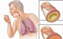 4 cách làm sạch phổi phòng tránh ung thư