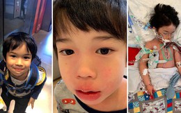 Bé trai 4 tuổi phải nằm viện 6 tháng vì bị nhiễm trùng máu và mắc bệnh do "vi khuẩn ăn thịt", triệu chứng ban đầu chỉ là đau chân