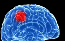 Chuyên gia bệnh viện K Trung ương chỉ ra 8 bất thường có thể là dấu hiệu của u não