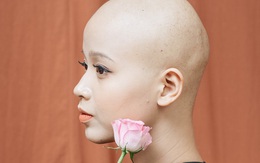Nữ sinh Ngoại thương mắc ung thư được Thủ tướng Nguyễn Xuân Phúc gửi thư động viên: "Bác tin rằng cháu sẽ là người chiến thắng"
