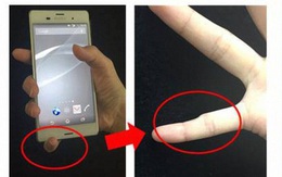 Ngón tay cong vẹo, biến dạng: Tình trạng dễ thấy ở những người dùng điện thoại quá lâu, quá nhiều