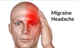 Bác sĩ cảnh báo: Đau đầu có những dấu hiệu bất thường sau cần phải đến viện gấp