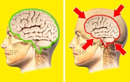 Não bộ sẽ co lại nếu tình trạng căng thẳng xảy ra thường xuyên, may mắn thay, đây là chìa khóa dành cho bạn!