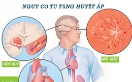 12 triệu người Việt mắc căn bệnh gây ra tai biến mạch máu não: Bộ Y tế đề nghị giảm ăn muối