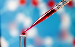 Khám phá khoa học mới: Xét nghiệm máu có thể chẩn đoán 5 loại bệnh ung thư trước khi phát bệnh tới vài năm!