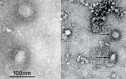 TQ công bố "chân dung" virus corona: Sự nguy hiểm chết người đằng sau tử thần nhỏ hơn cả bụi siêu mịn